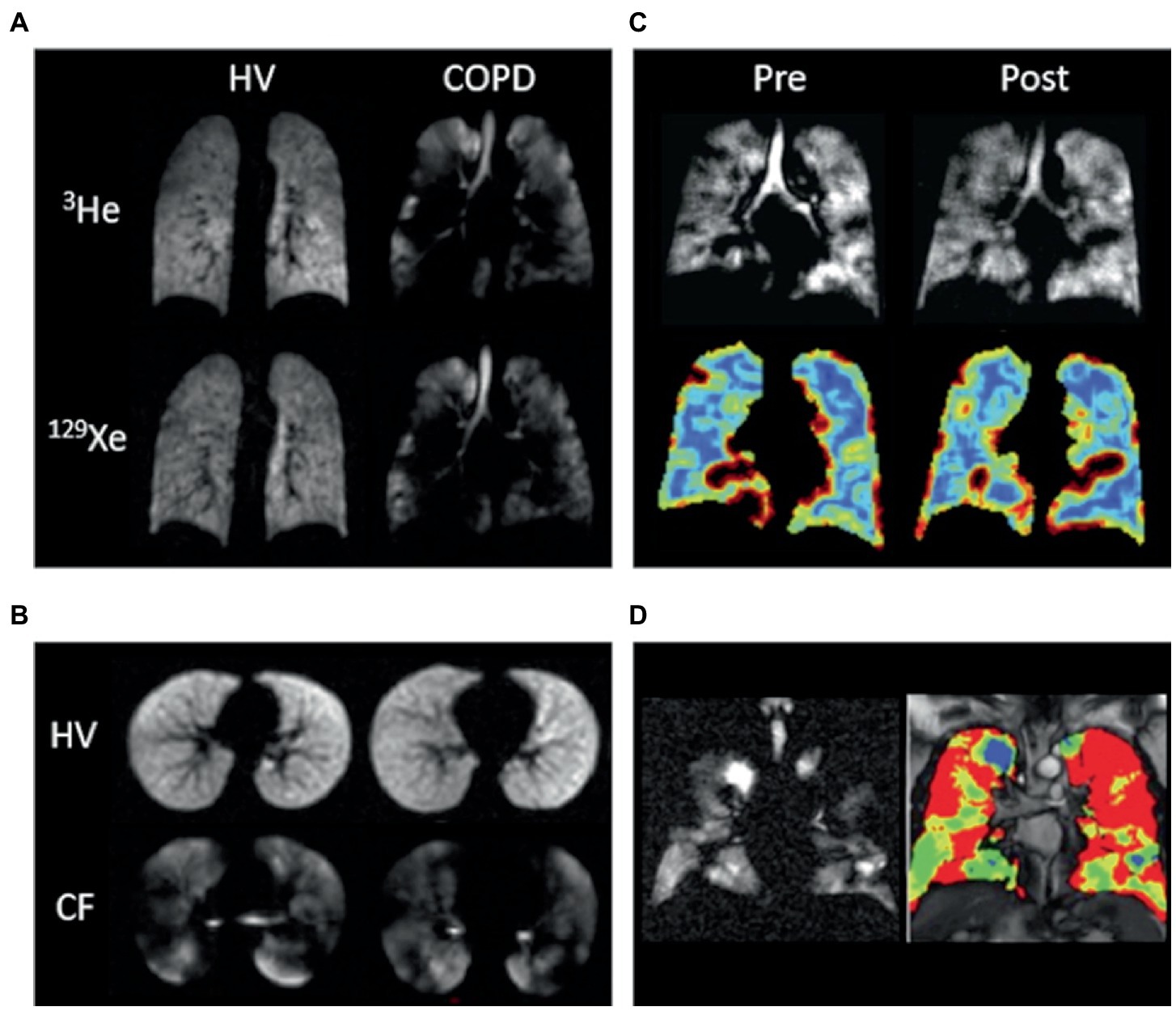 Journal of Magnetic Resonance Imaging: Vol 55, No 1