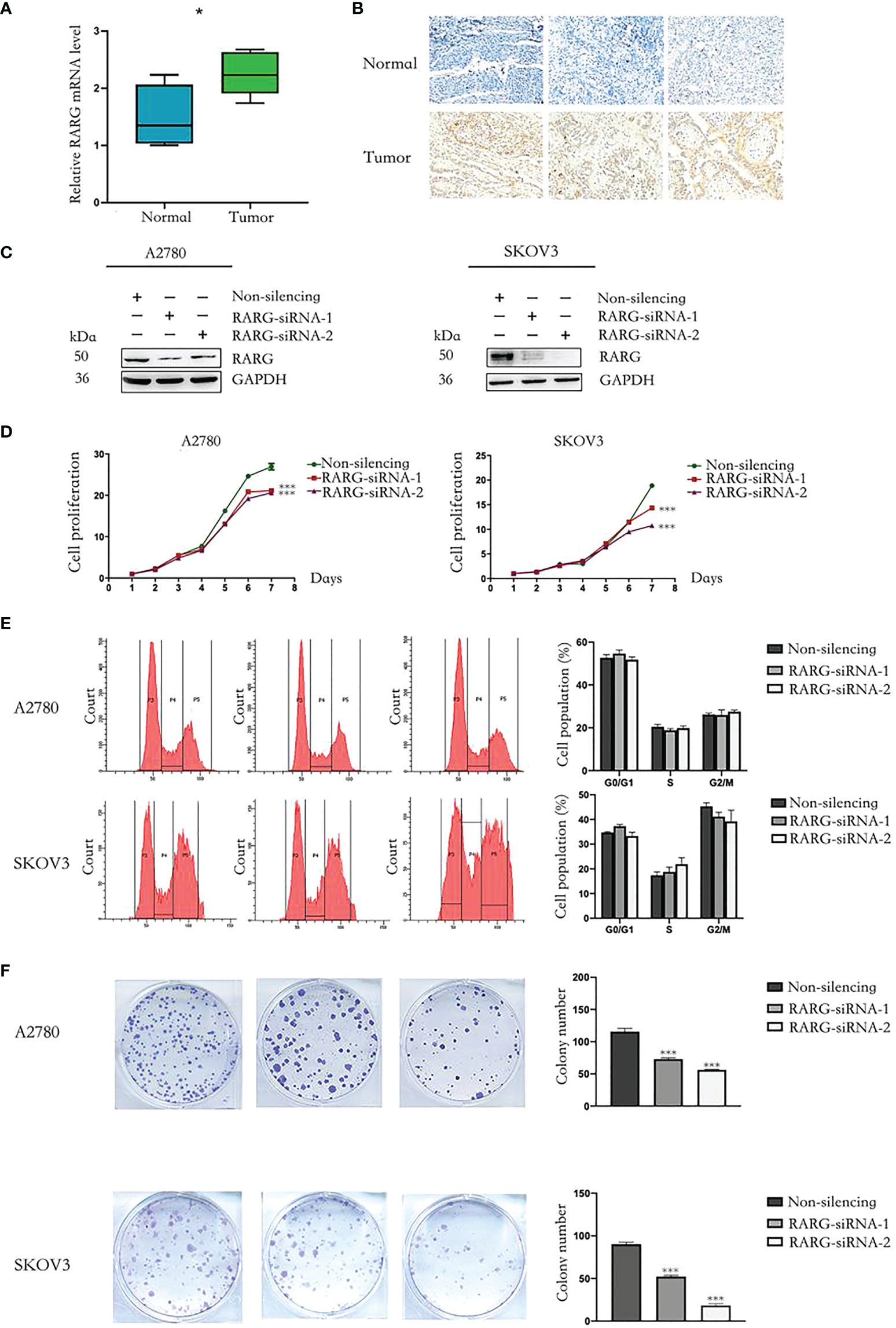 Frontiers | High expression of RARG accelerates ovarian cancer ...