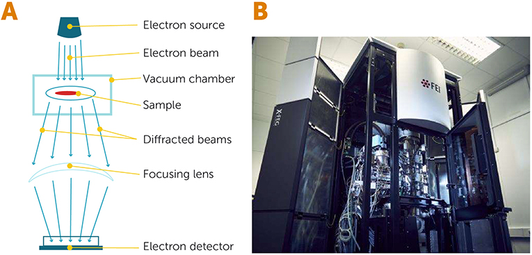 Figure 2 - Electron microscopy.