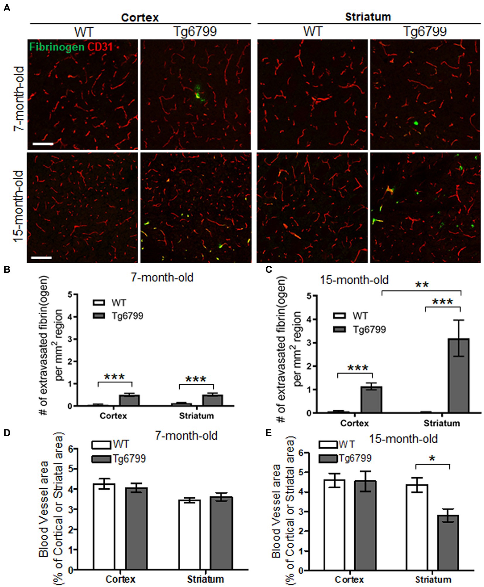 Frontiers  Striatal fibrinogen extravasation and vascular degeneration  correlate with motor dysfunction in an aging mouse model of Alzheimer's  disease