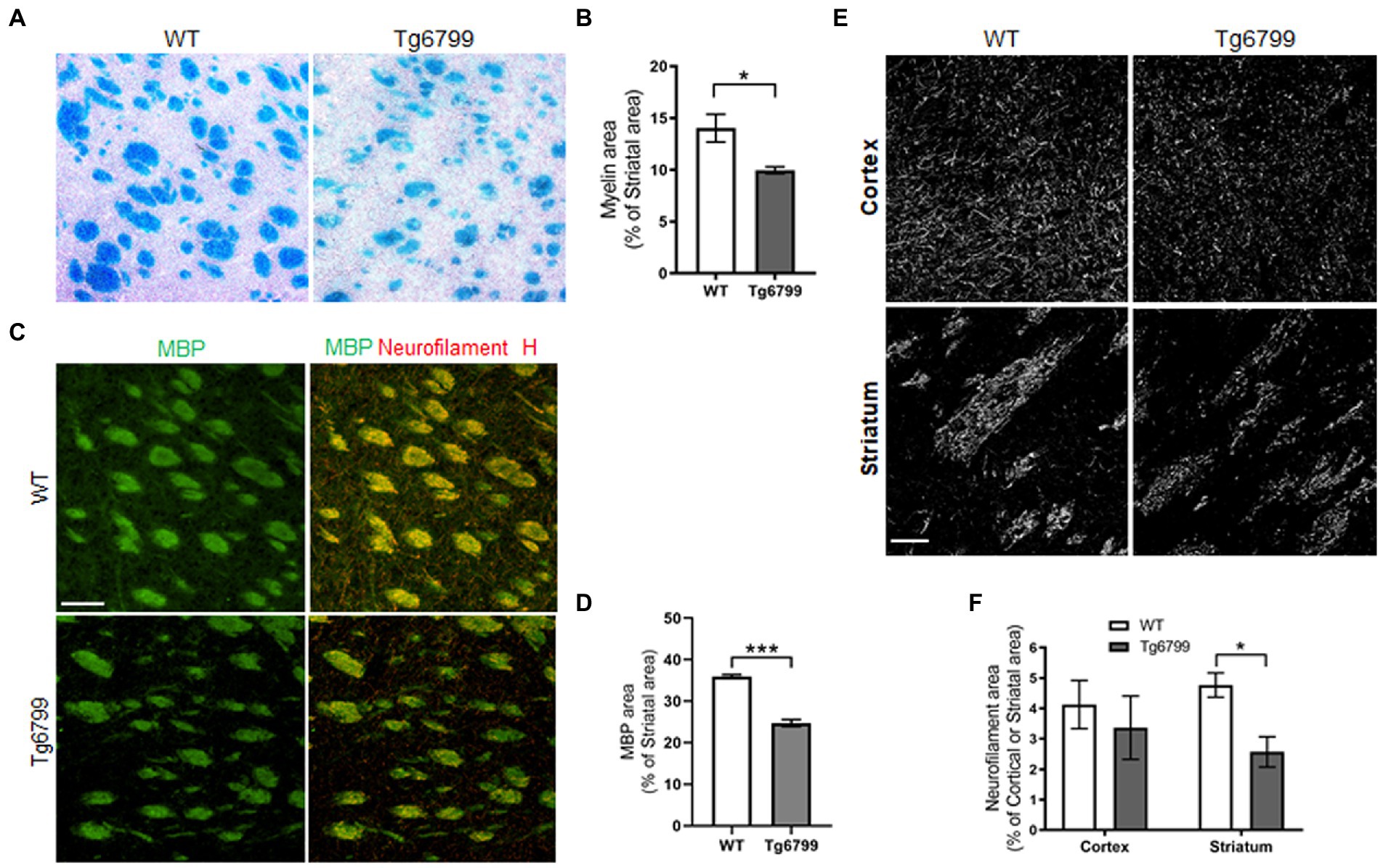 Frontiers  Striatal fibrinogen extravasation and vascular degeneration  correlate with motor dysfunction in an aging mouse model of Alzheimer's  disease