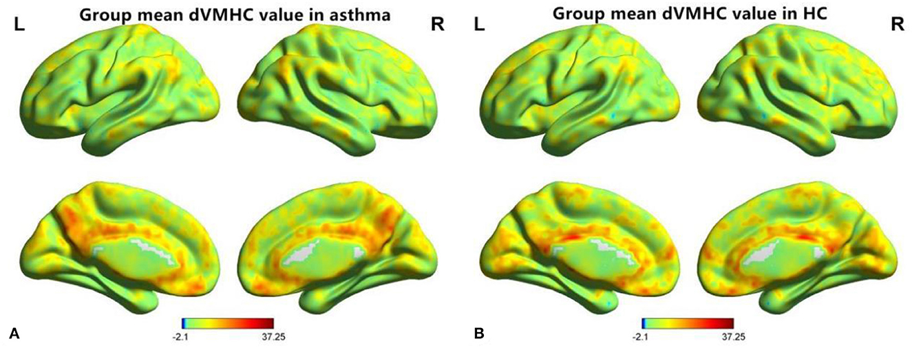 Frontiers | Asthma's effect on brain connectivity and cognitive
