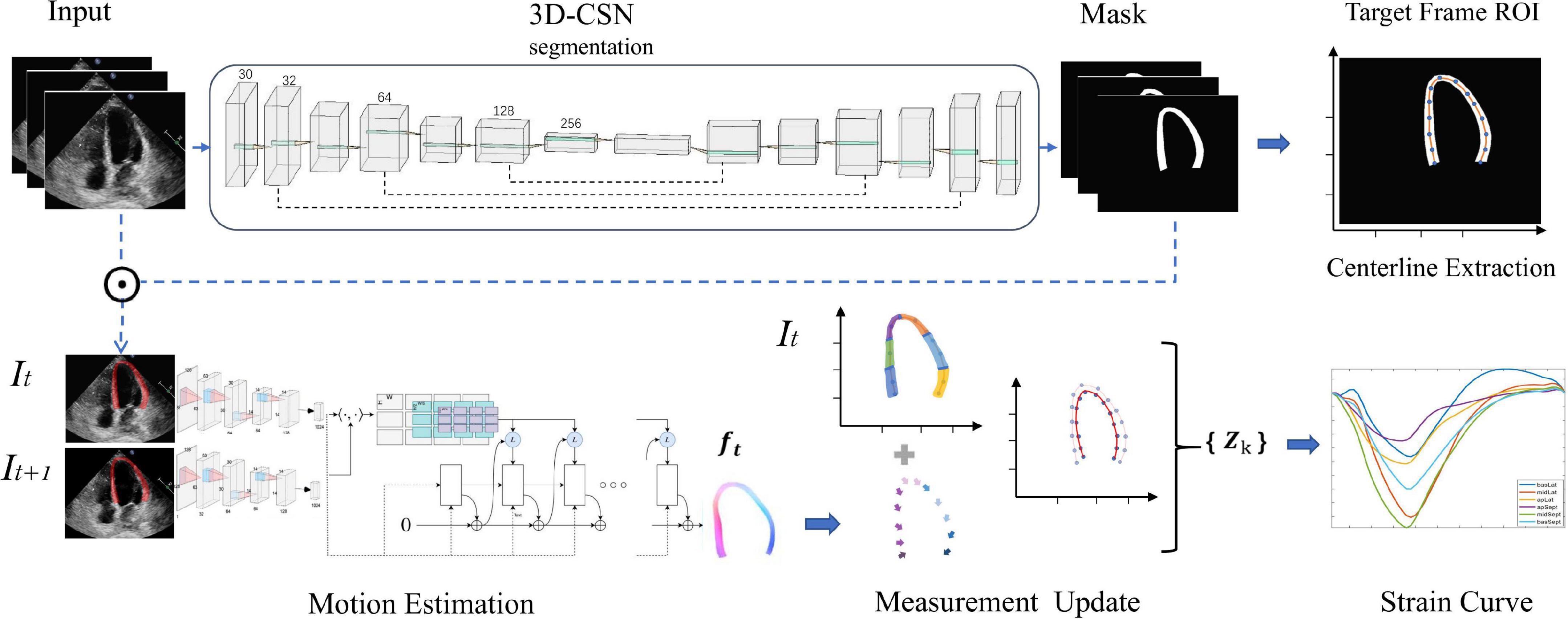 Principles and Practical Aspects of Strain Echocardiography