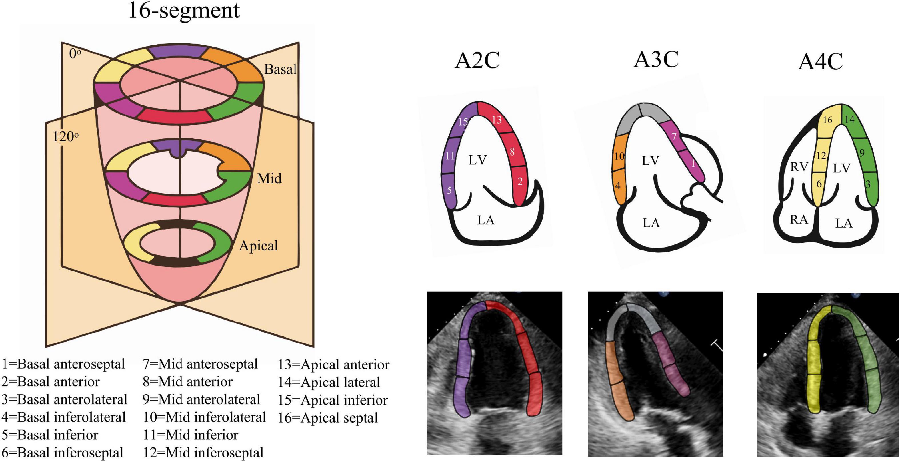 Analysis of myocardial strain of the left ventricle based on 2-D