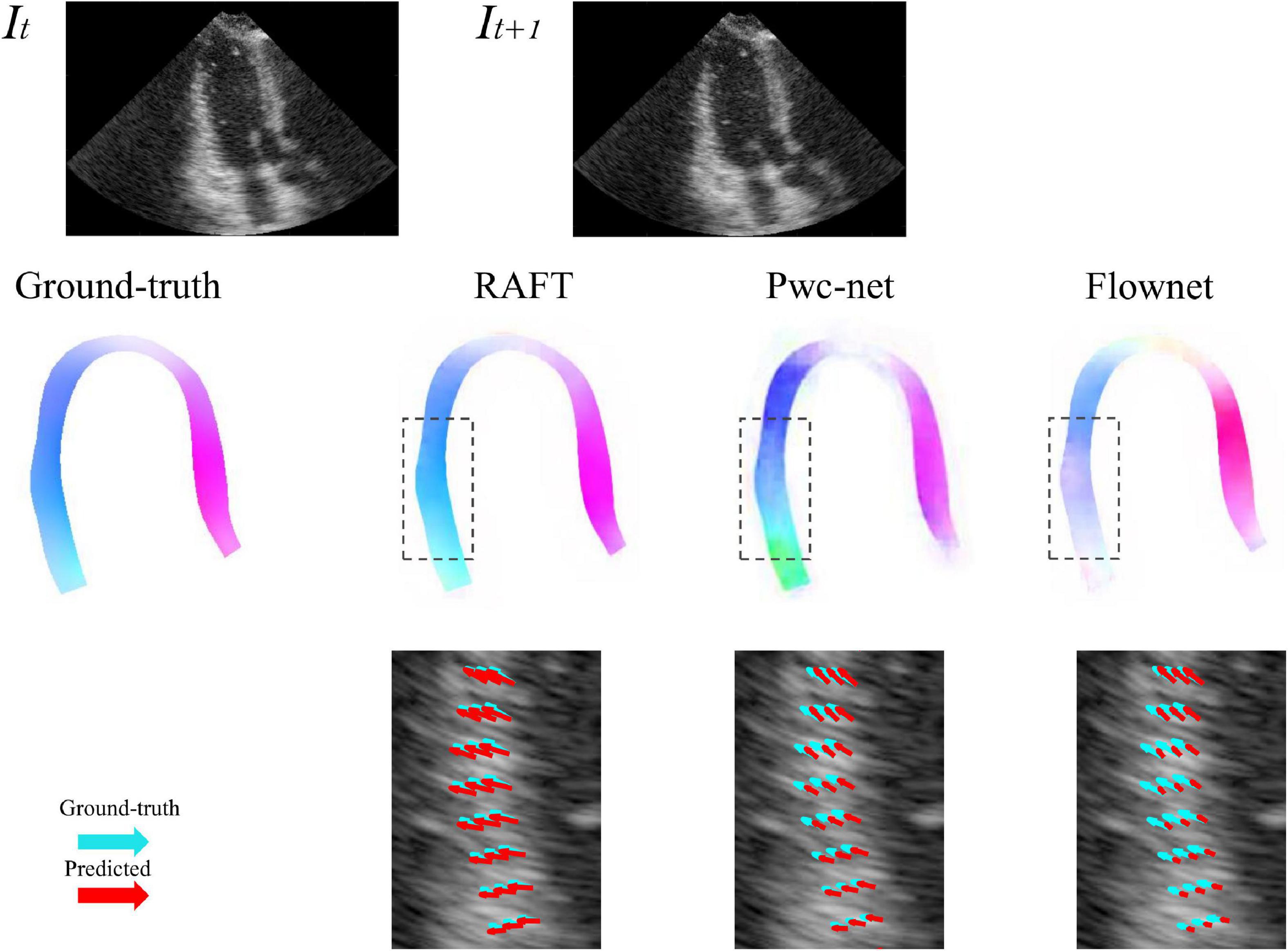 Frontiers  Myocardial strain analysis of echocardiography based on deep  learning