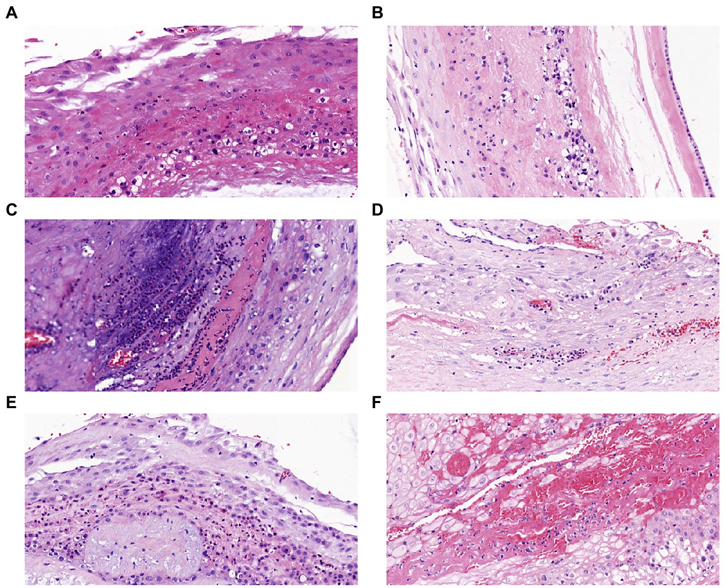Frontiers | The role of upper and lower genital tract microbiota