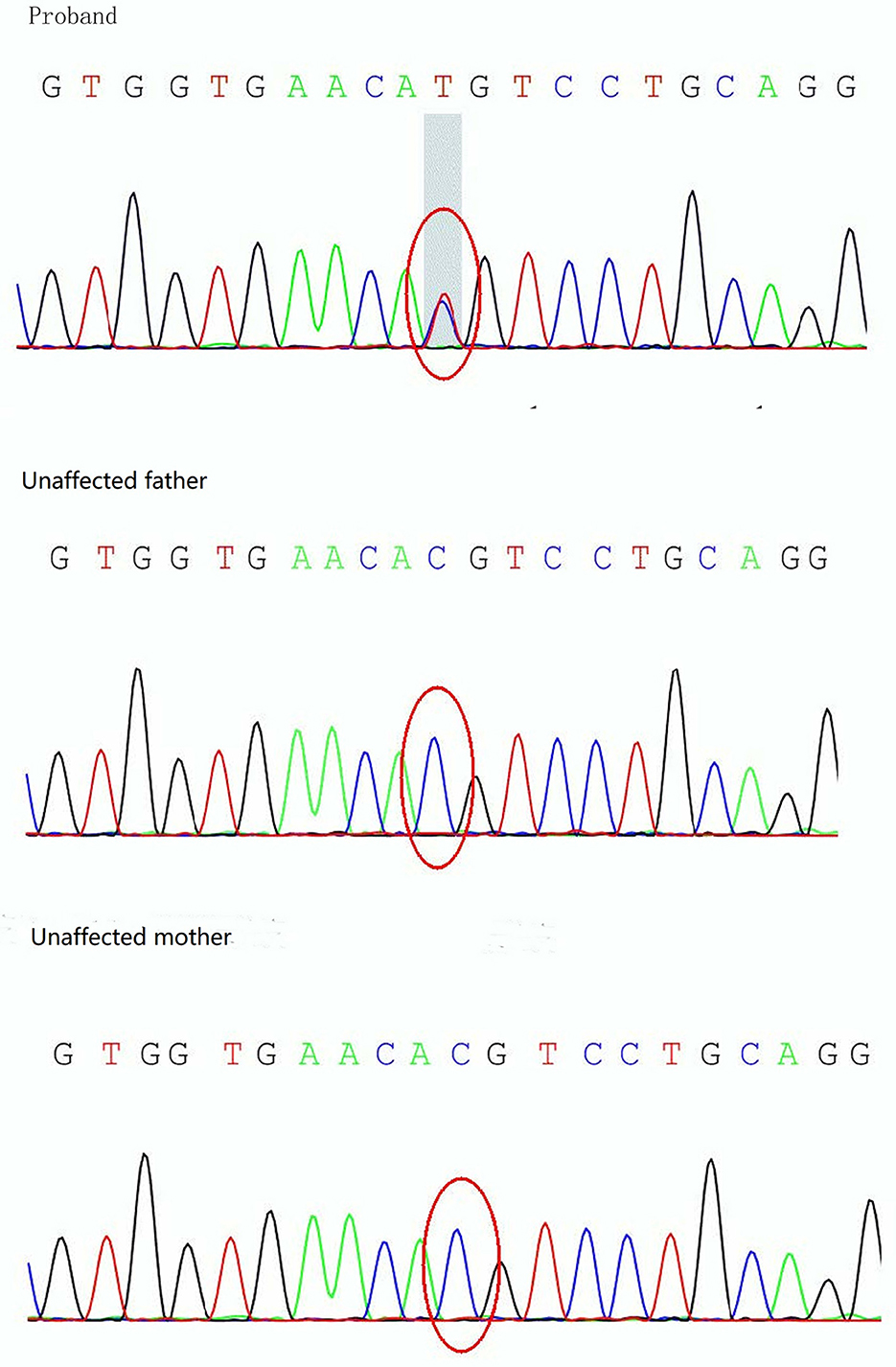 Frontiers  Case report: A 10-year prognosis of neonatal diabetes