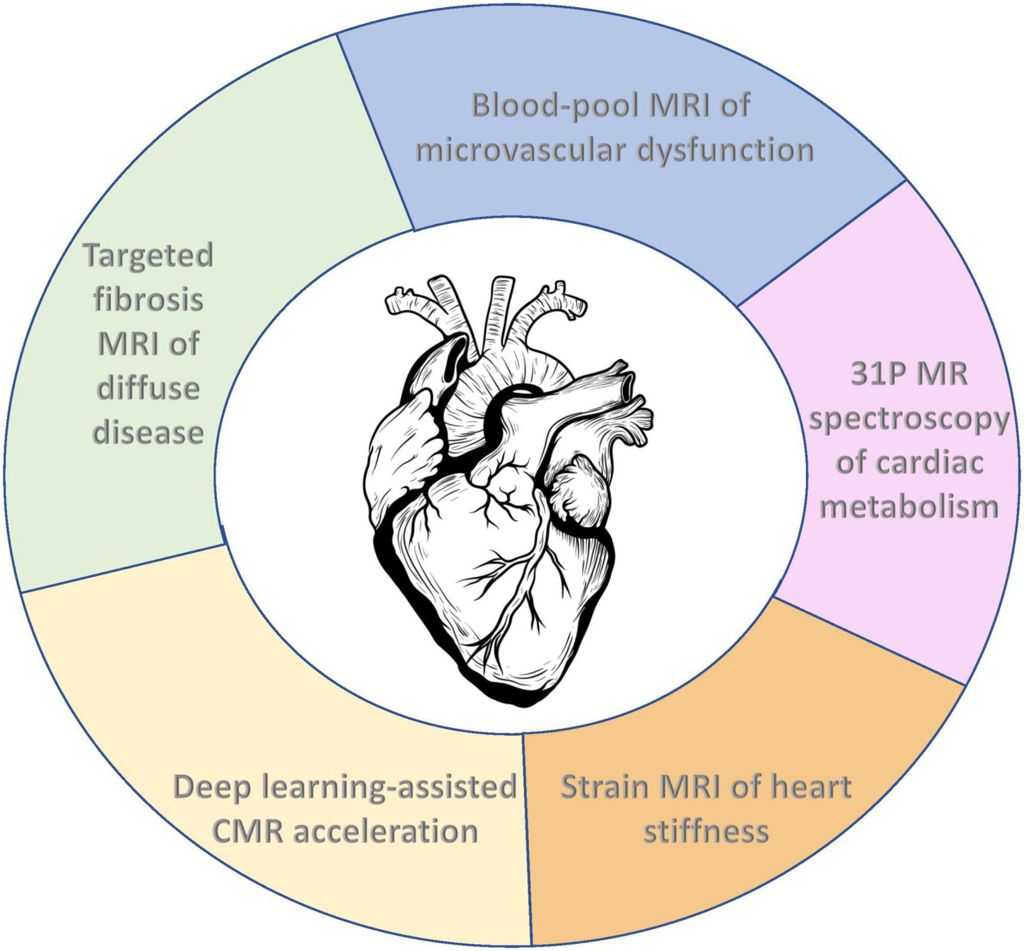 Myocardial Strain Evaluation with Cardiovascular MRI: Physics, Principles,  and Clinical Applications