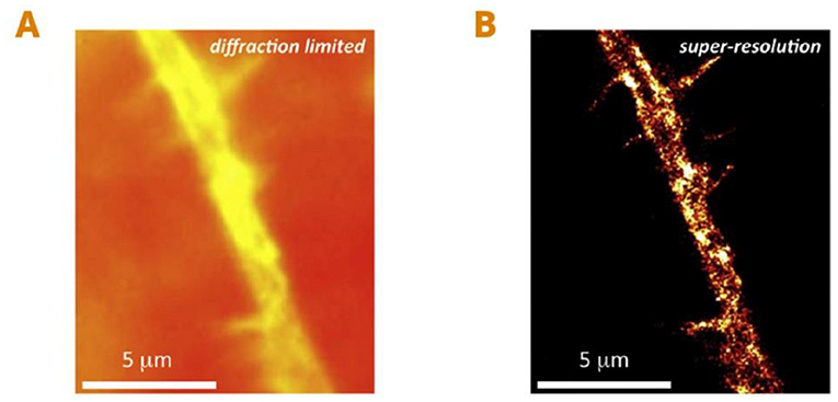 Figure 3 - Seeing individual proteins in living cells using super-resolution microscopy.