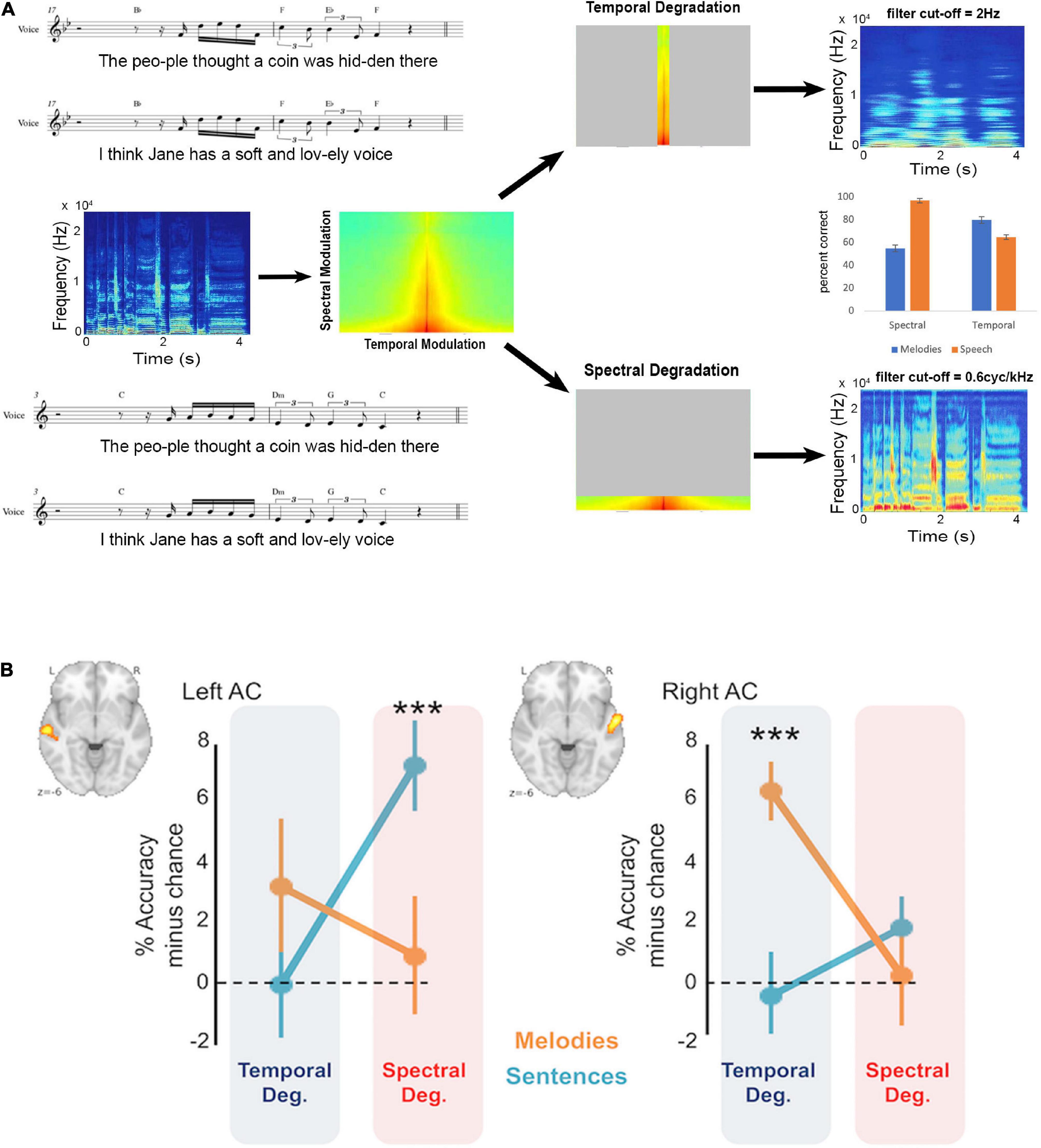 Frontiers  Hemispheric asymmetries for music and speech