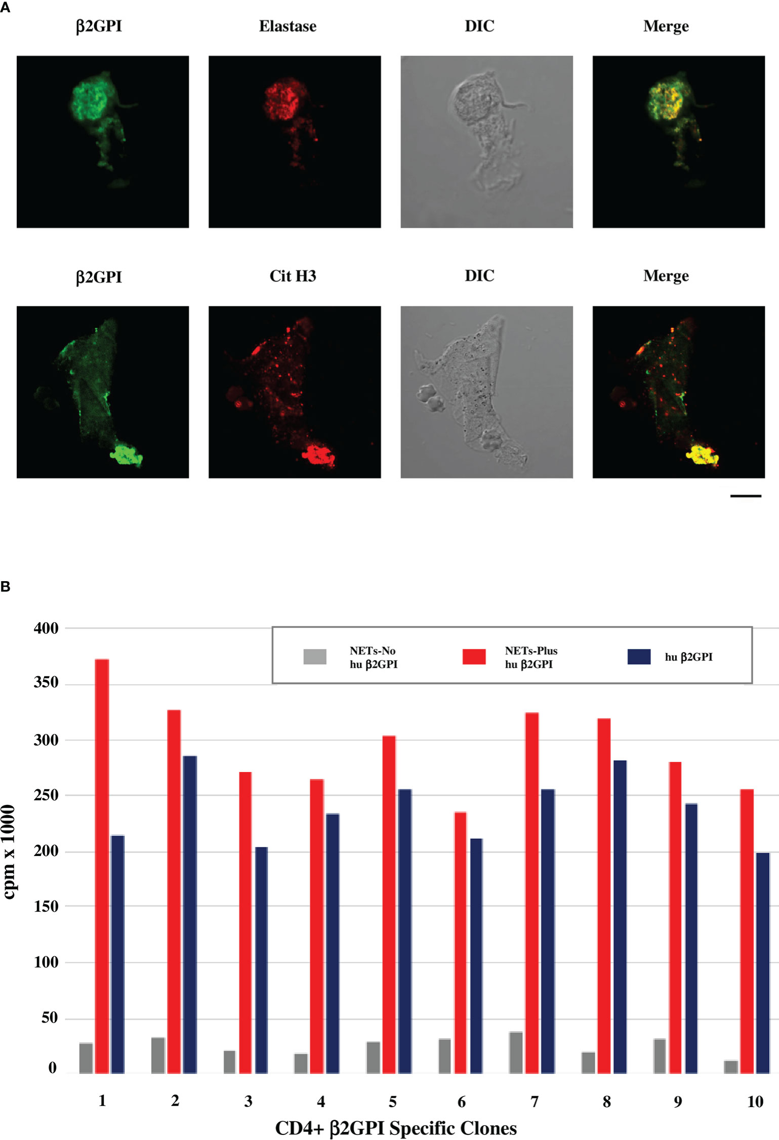 Frontiers  Beta 2 glycoprotein I and neutrophil extracellular traps:  Potential bridge between innate and adaptive immunity in anti-phospholipid  syndrome