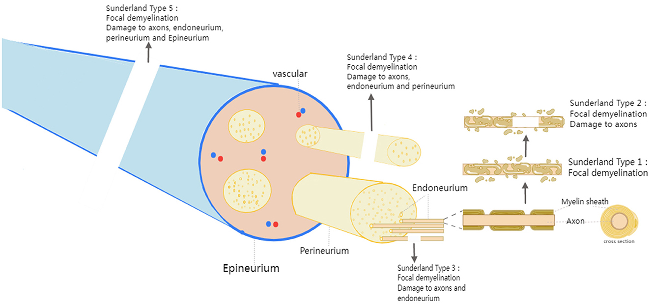 Electrical stimulation found to revitalize muscle perfusion caused