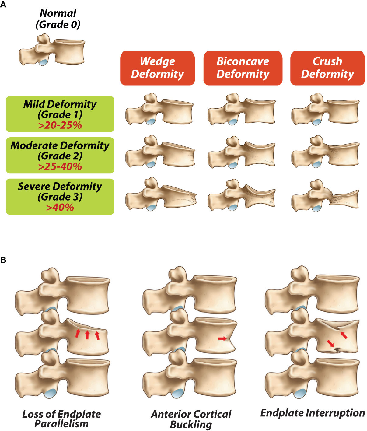 Frontiers  Bone health in childhood and adolescence: an overview on  dual-energy X-ray absorptiometry scanning, fracture surveillance and  bisphosphonate therapy for low-middle-income countries