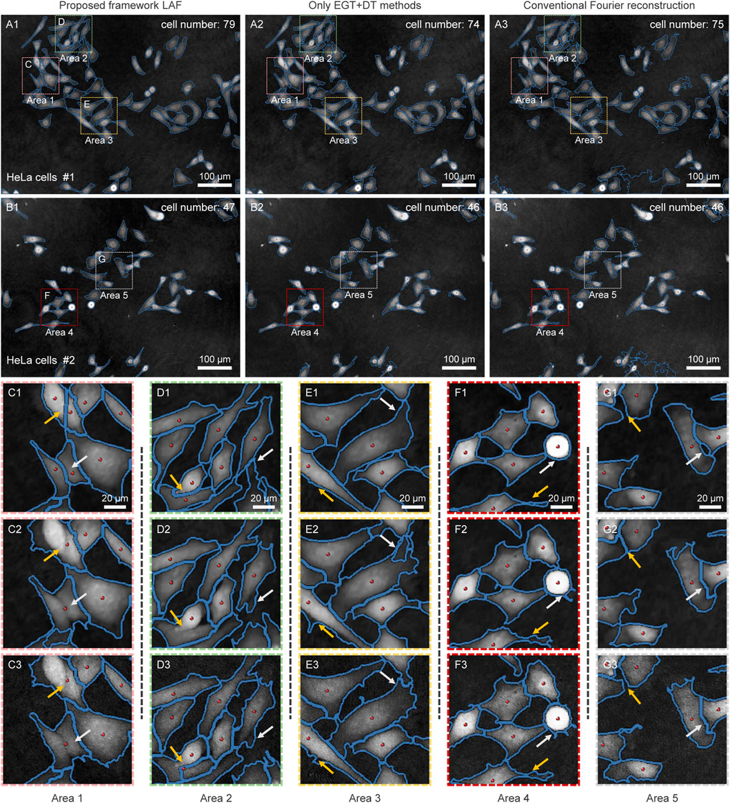 Frontiers  Live-cell analysis framework for quantitative phase