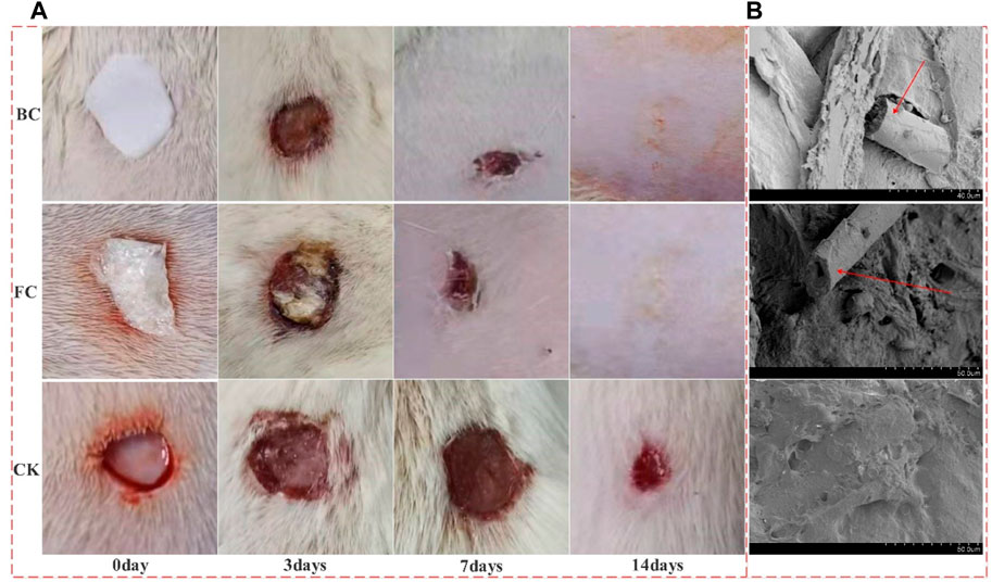 Frontiers | Effects and metabolism of fish collagen sponge in repairing ...