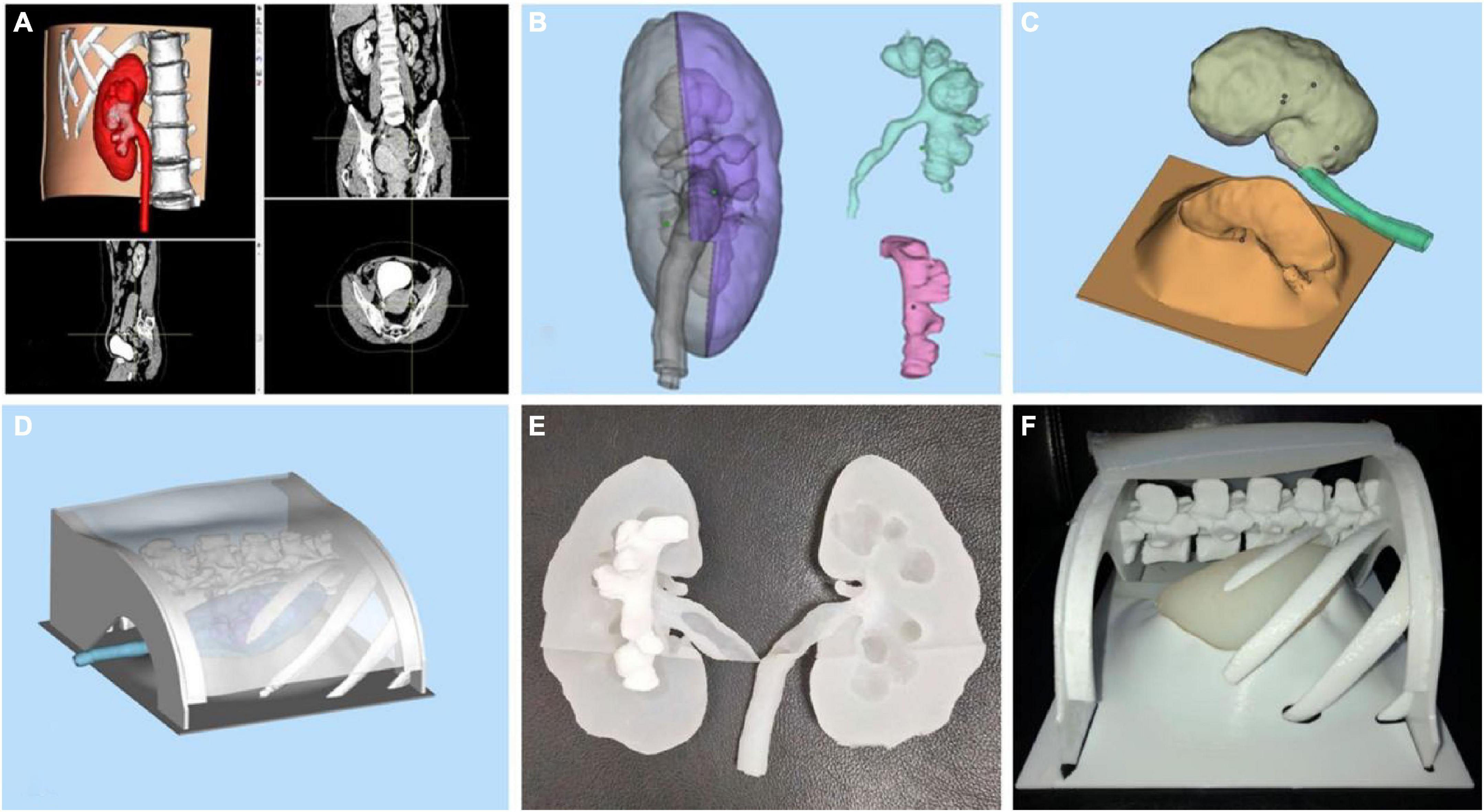 Frontiers | Application of three-dimensional printing technology in ...