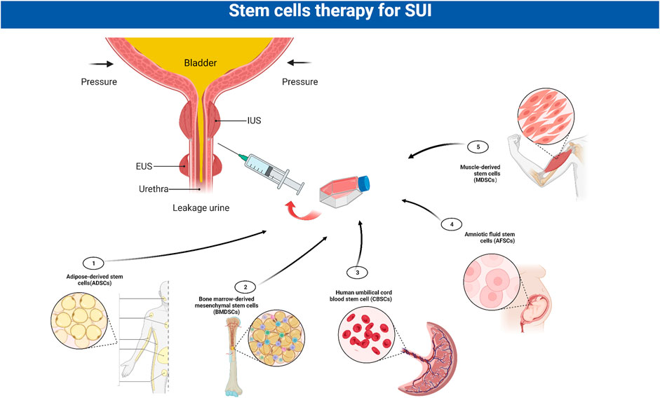 Frontiers  Advances in the molecular pathogenesis and cell