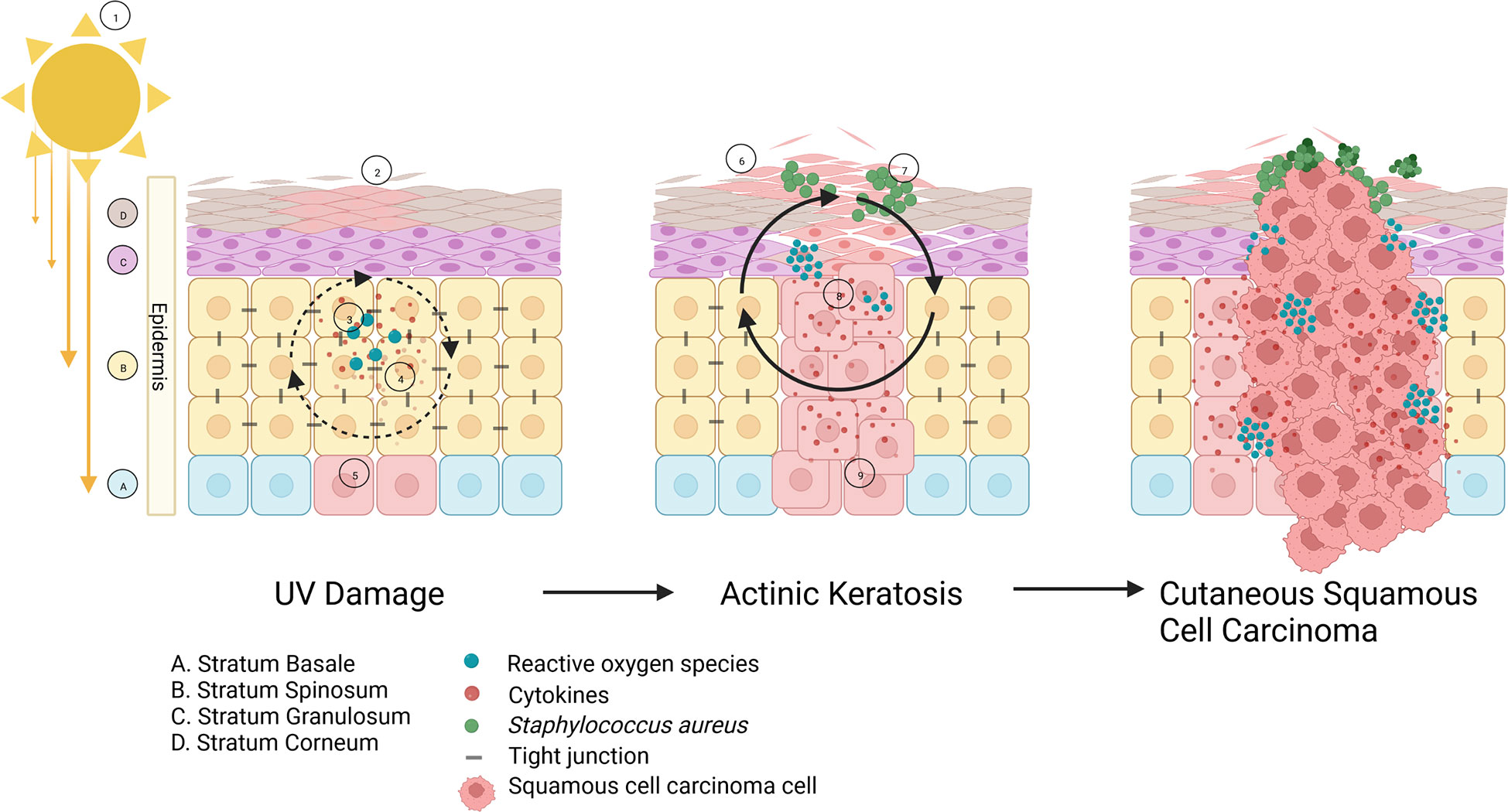 Staphylococcus aureus: A Blemish on Skin Immunity: Cell Host & Microbe