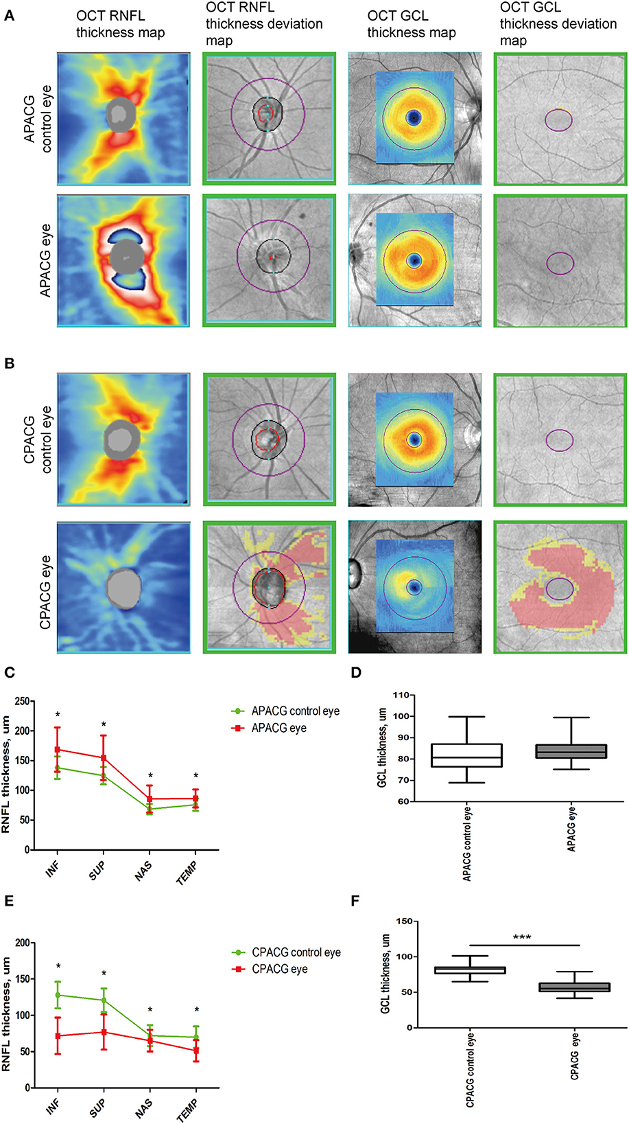 Frontiers Alteration of neurofilament heavy chain and its phosphoforms reveals early subcellular damage beyond the optic nerve head in glaucoma image