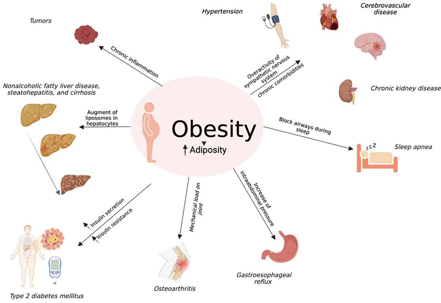 Frontiers Effect Of Dual Glucose dependent Insulinotropic Peptide prescription-weight-loss-drug-what-you-need-to-know-wtsp