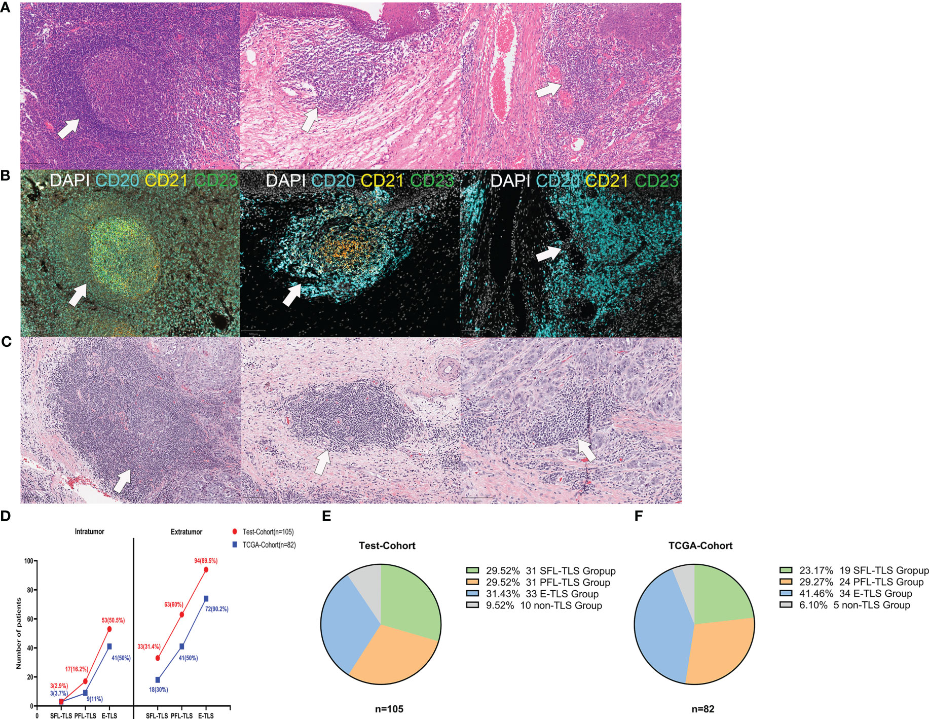 Tertiary lymphoid structures generate and propagate anti-tumor