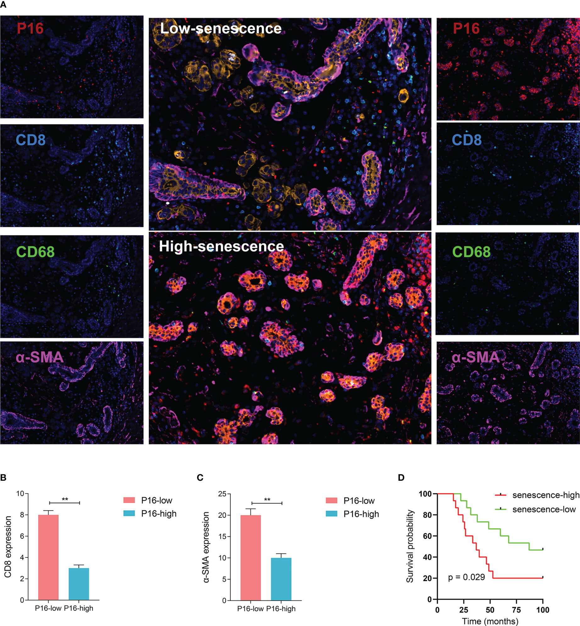 Frontiers | Tumor senescence leads to poor survival and