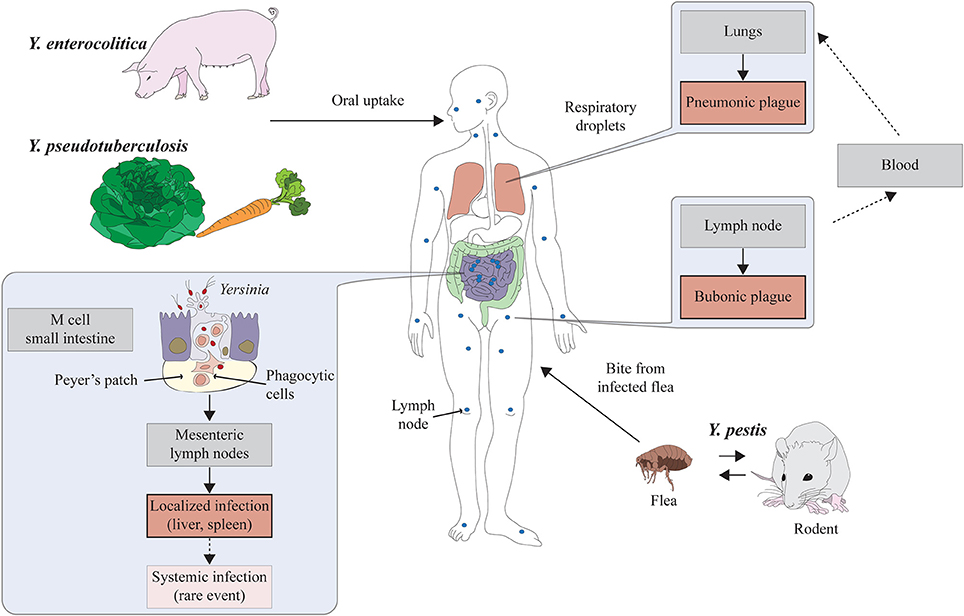 Cetosi diabetiva y cetoacidosi