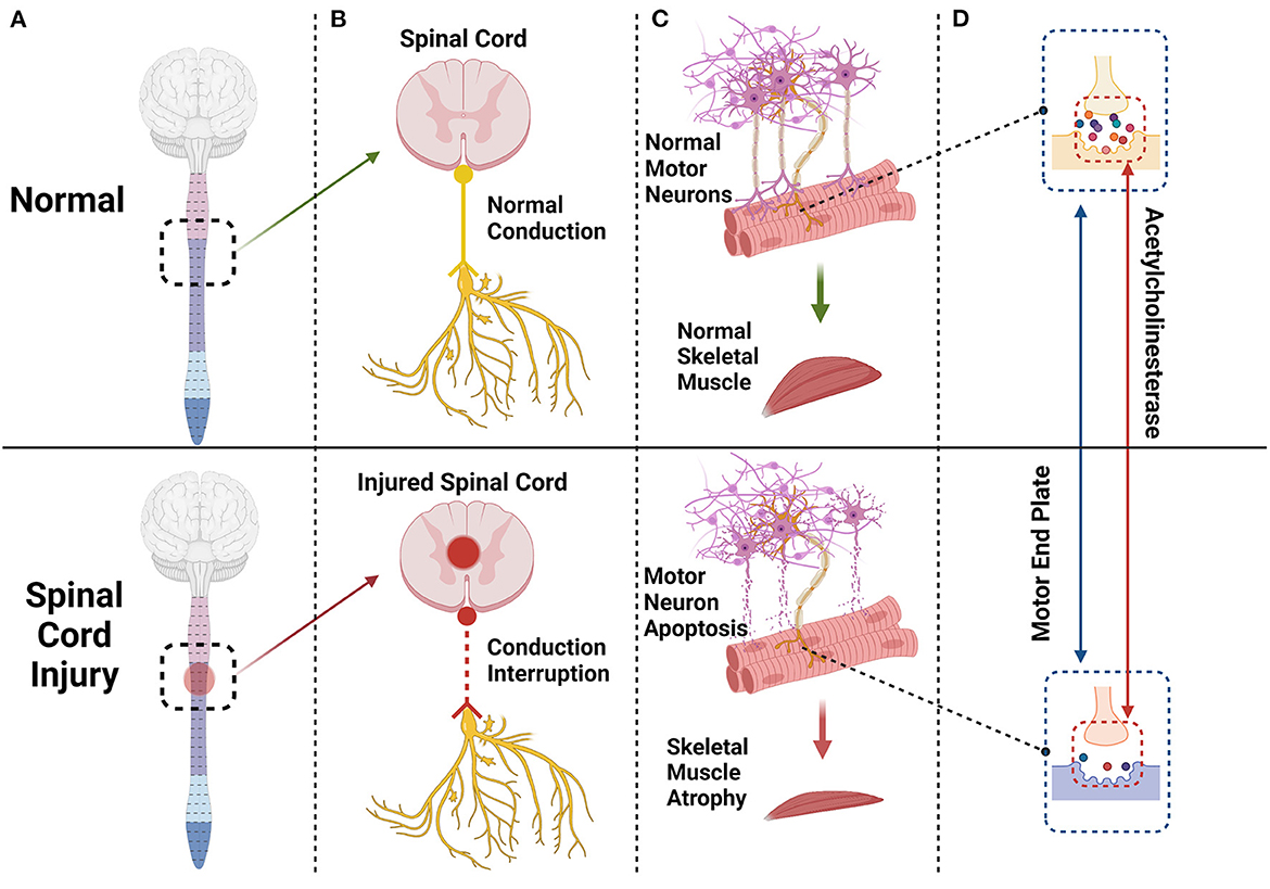 Frontiers Mechanism Of Skeletal Muscle Atrophy After Spinal Cord 