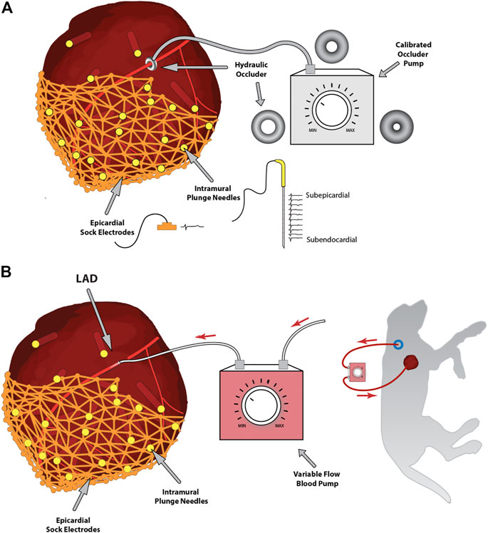 Needle geometry measurements. (a) Length of the hair implant needle (A=