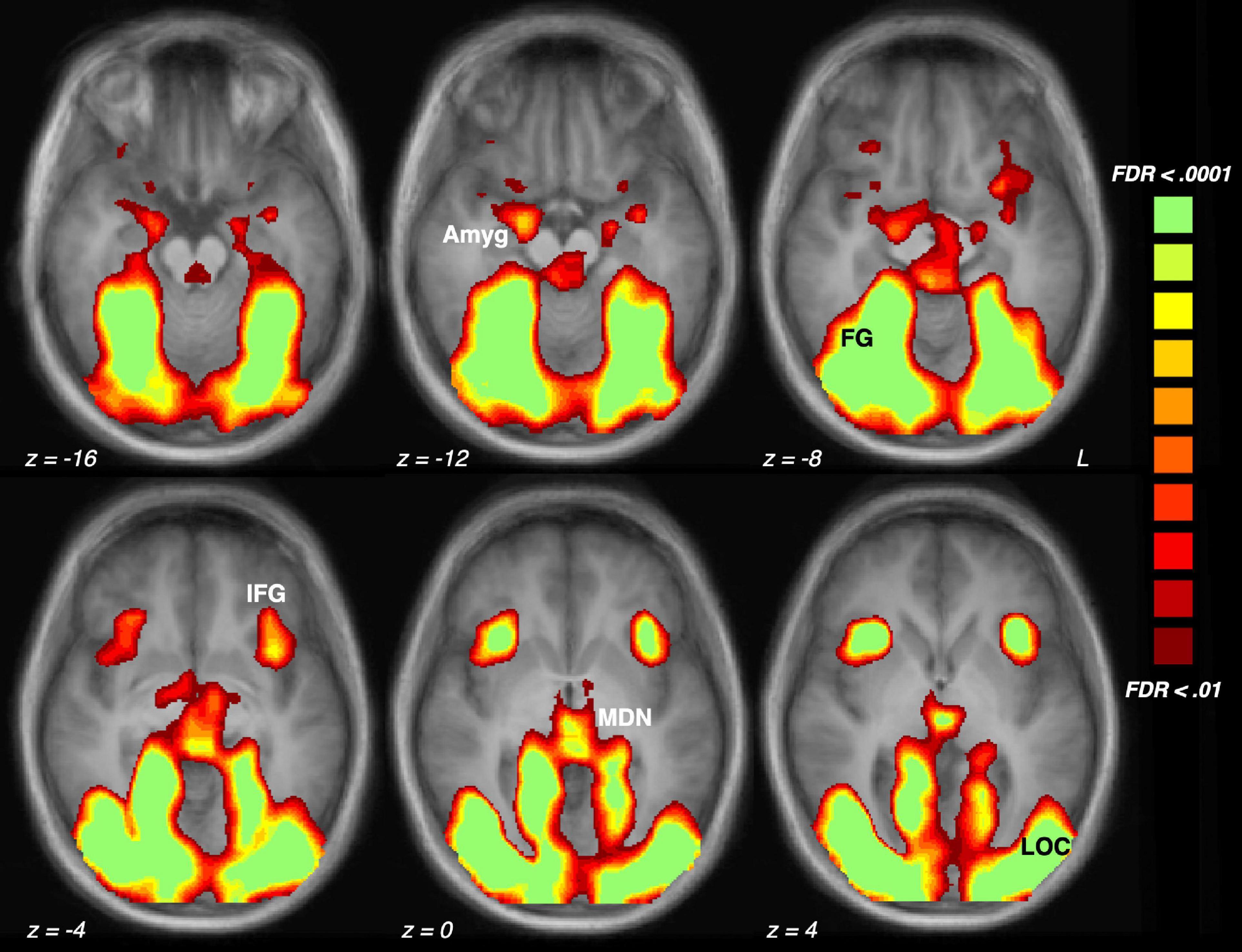 Frontiers  A 5-min paradigm to evoke robust emotional reactivity in  neuroimaging studies