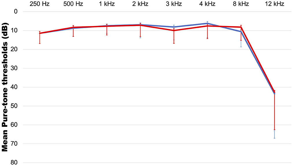 Tinnitus and normal hearing: a study on the transient otoacoustic