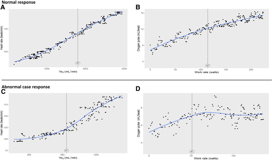 Frontiers  The utility of cardiopulmonary exercise testing in