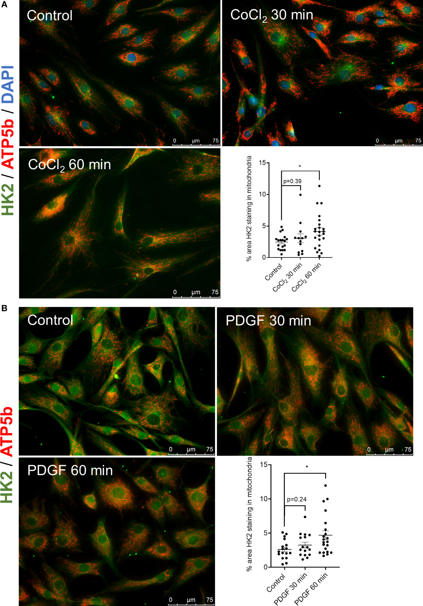 Frontiers   Role of mitochondria bound HK2 in rheumatoid arthritis