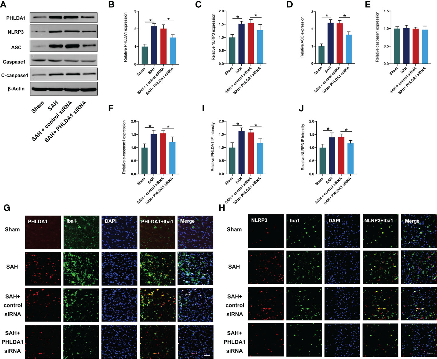 Frontiers | PHLDA1 modulates microglial response and NLRP3 inflammasome ...