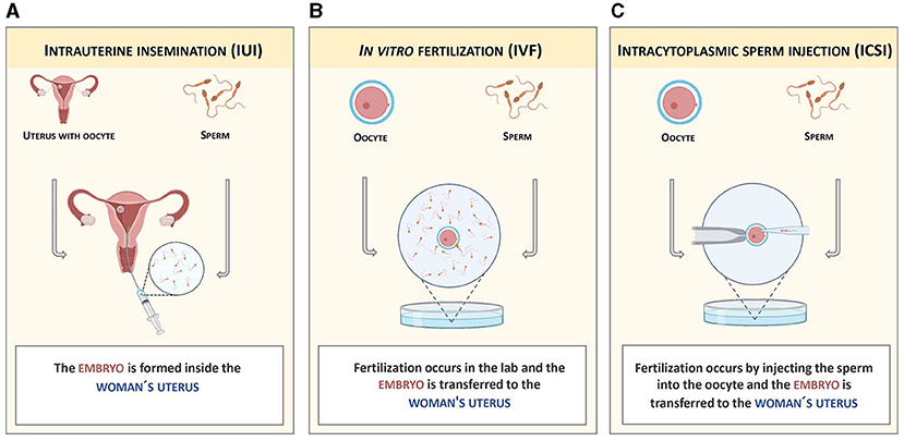 Figure 2 - Main types of assisted reproduction technologies.