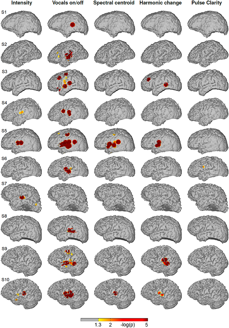 Frontiers  Gamma music: a new acoustic stimulus for gamma-frequency  auditory steady-state response