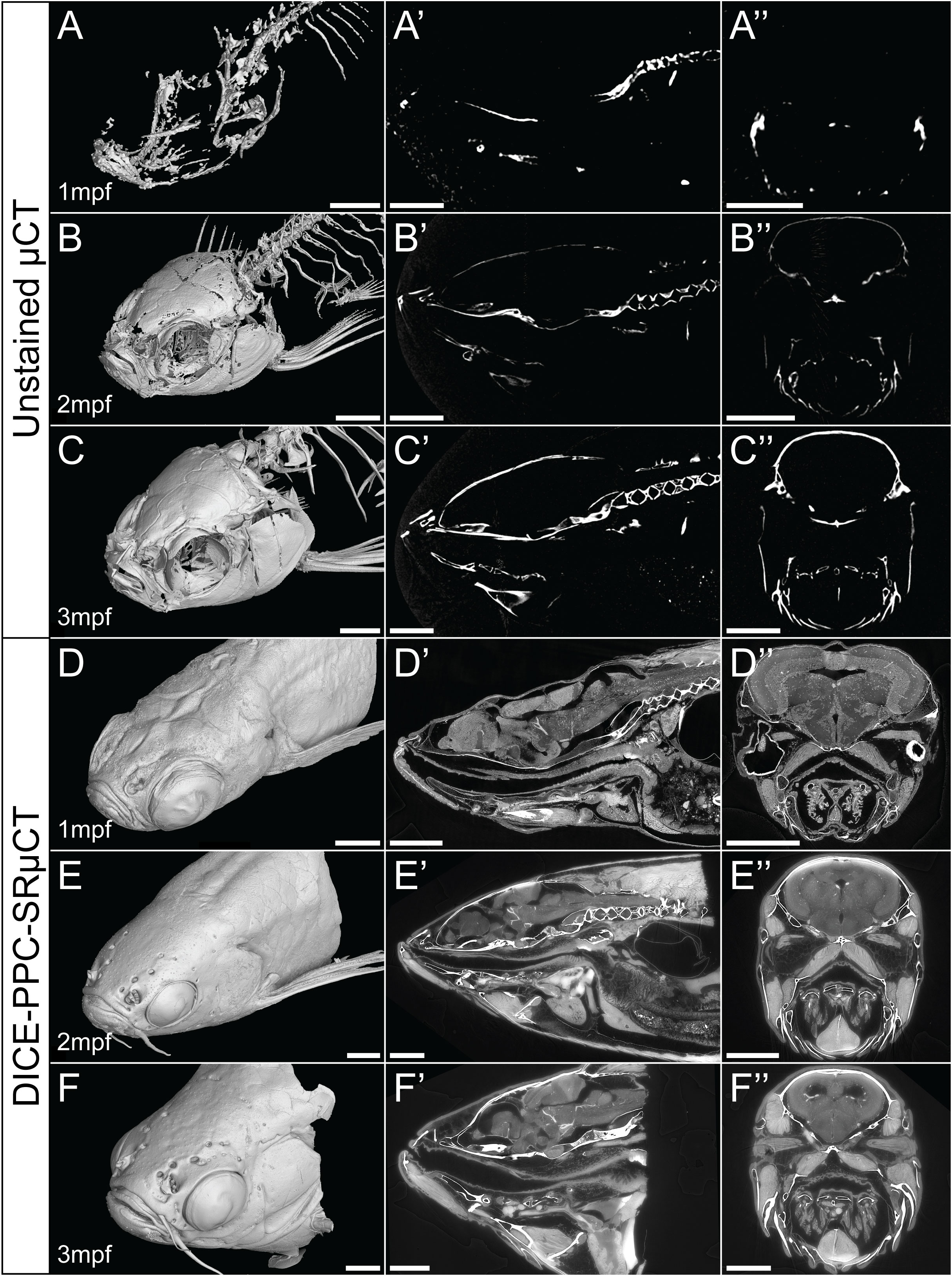 The First Dynamic Micro-CT System to Deliver Sub-Micron 3D Imaging