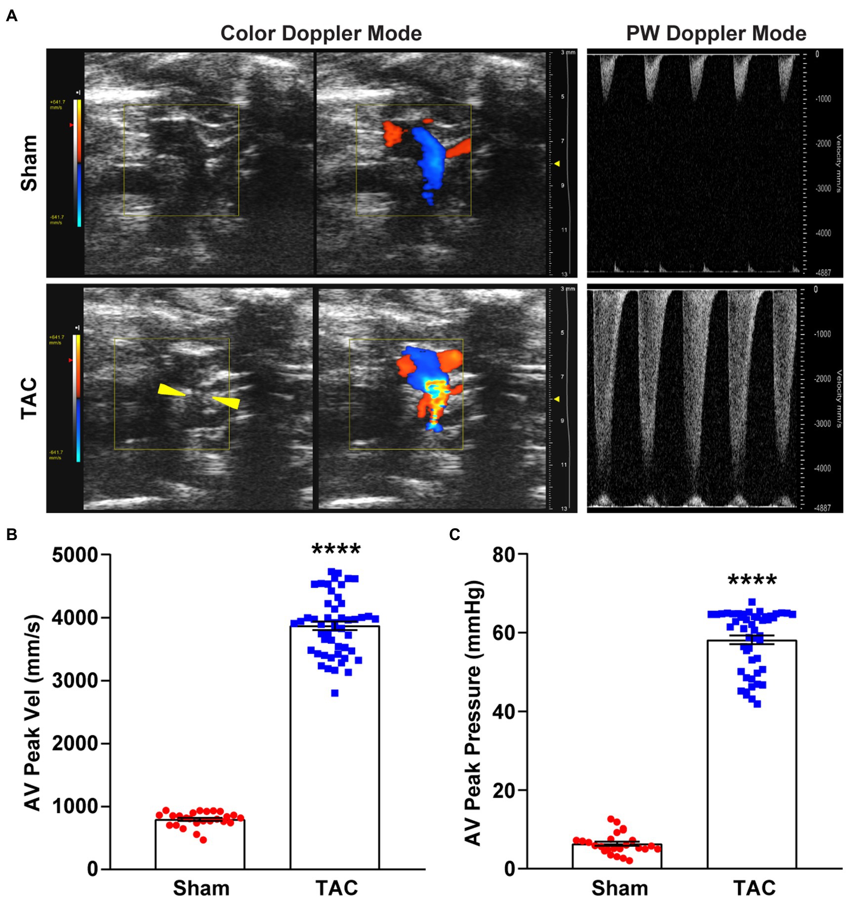 O-ring-induced transverse aortic constriction (OTAC) is a new simple method  to develop cardiac hypertrophy and heart failure in mice