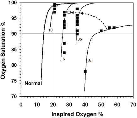 A more discriminative item was represented by (a) a steeper slope curve