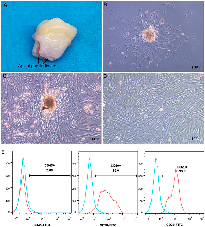 Frontiers | Effectiveness of biomechanically stable pergola