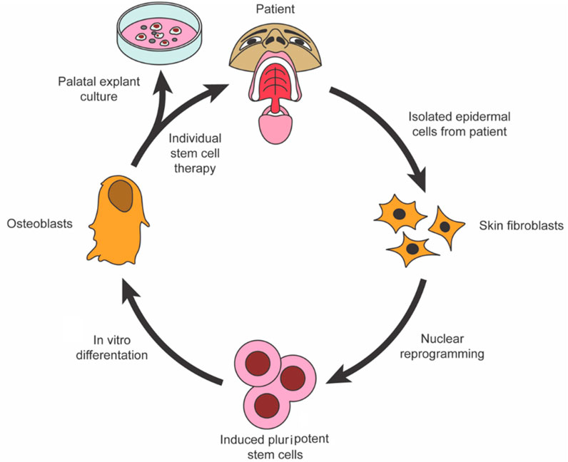 Frontiers  The current regenerative medicine approaches of craniofacial  diseases: A narrative review