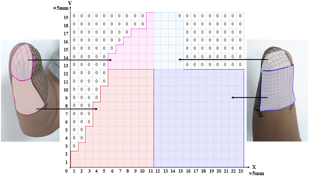 File:E-Stim TENS.jpg - Wikimedia Commons