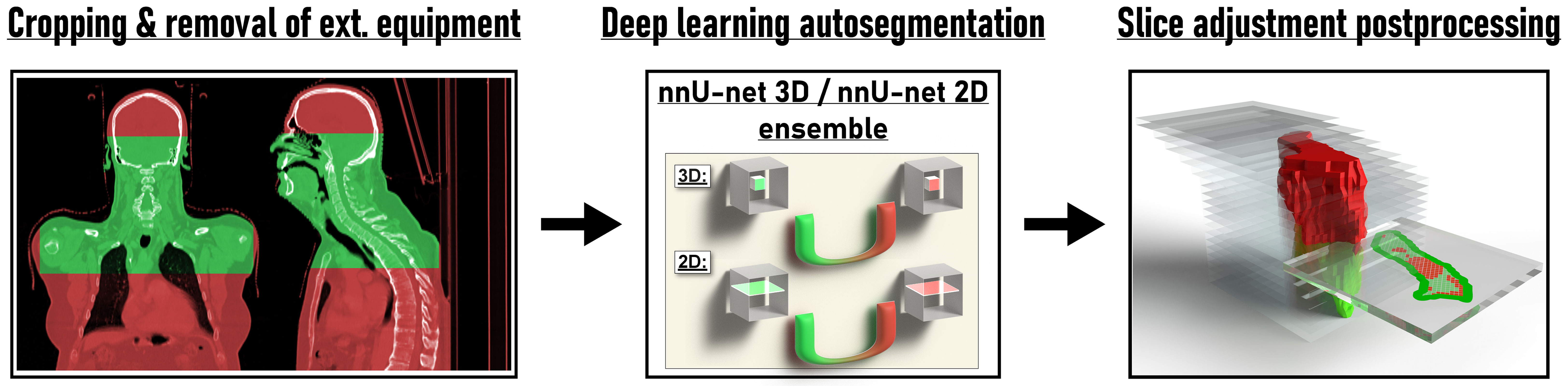 Frontiers  Deep learning for automatic head and neck lymph node level  delineation provides expert-level accuracy