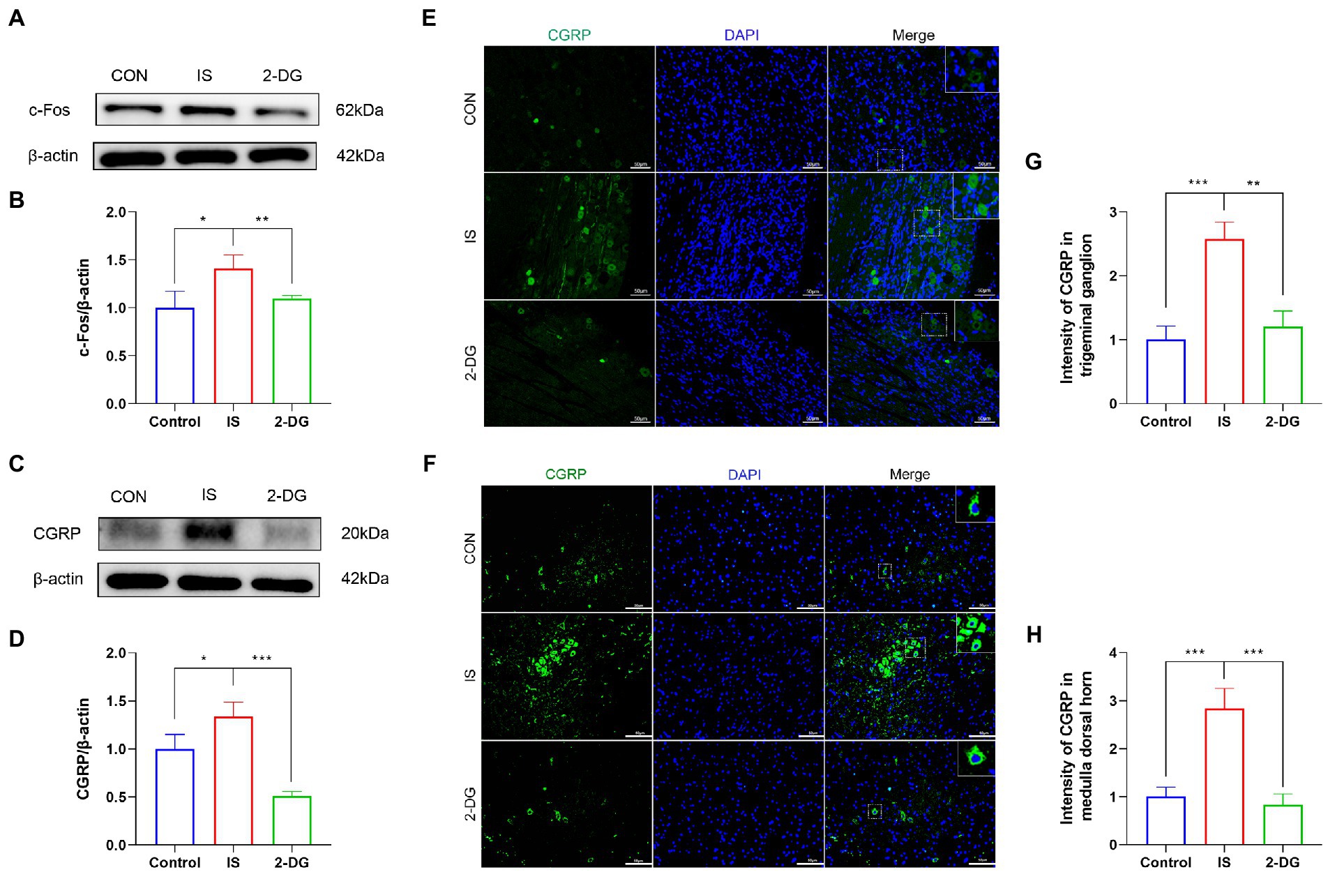 国内外の人気集結！ Frontiers | 2-Deoxyglucose alleviates migraine-related トップス