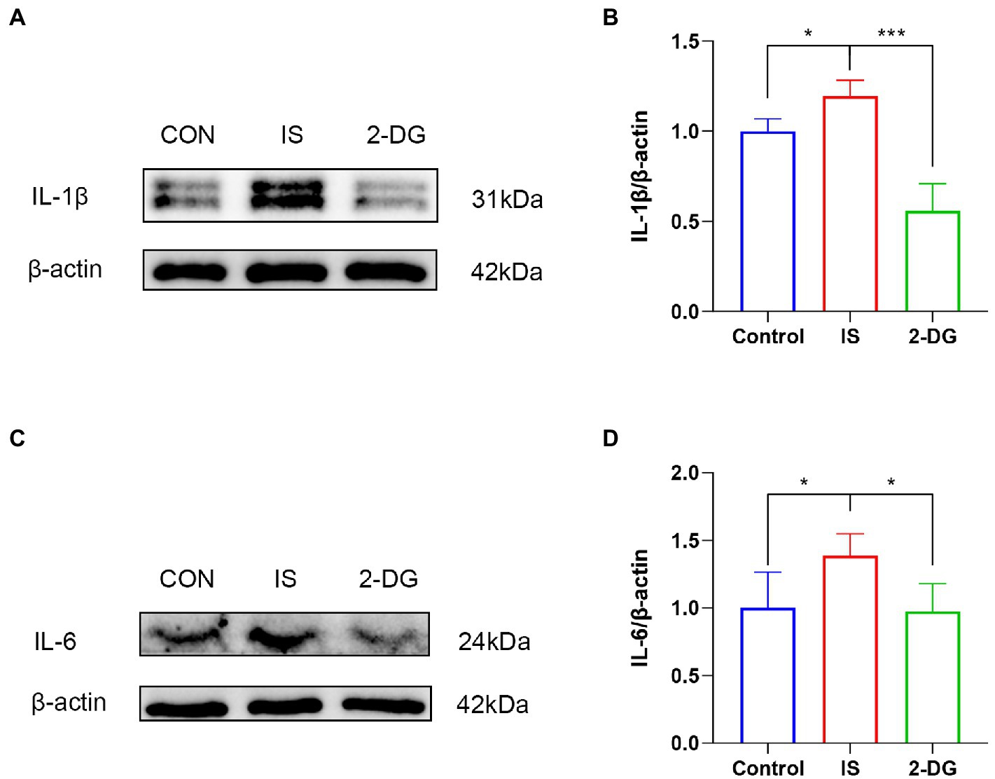 パリコレクション | Frontiers 2-Deoxyglucose migraine-related alleviates トップス