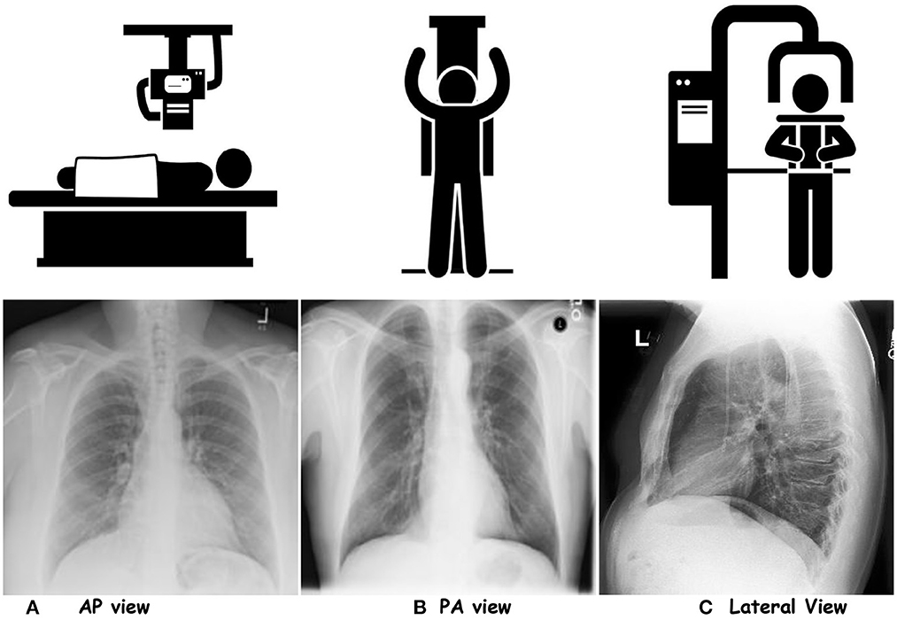 Dark field Chest X ray Imaging First Experience In 59 OFF