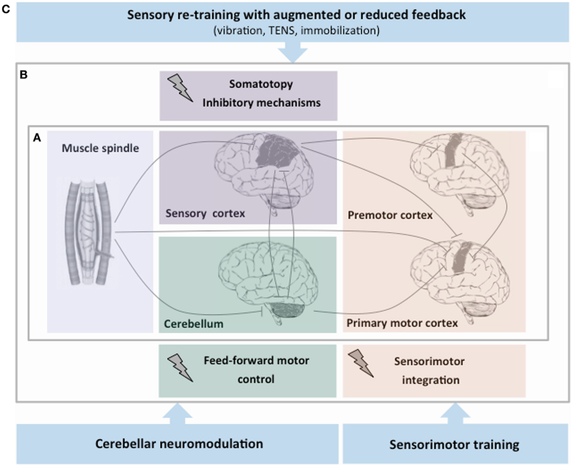 Frontiers | Proprioceptive Dysfunction in Focal Dystonia: From ...