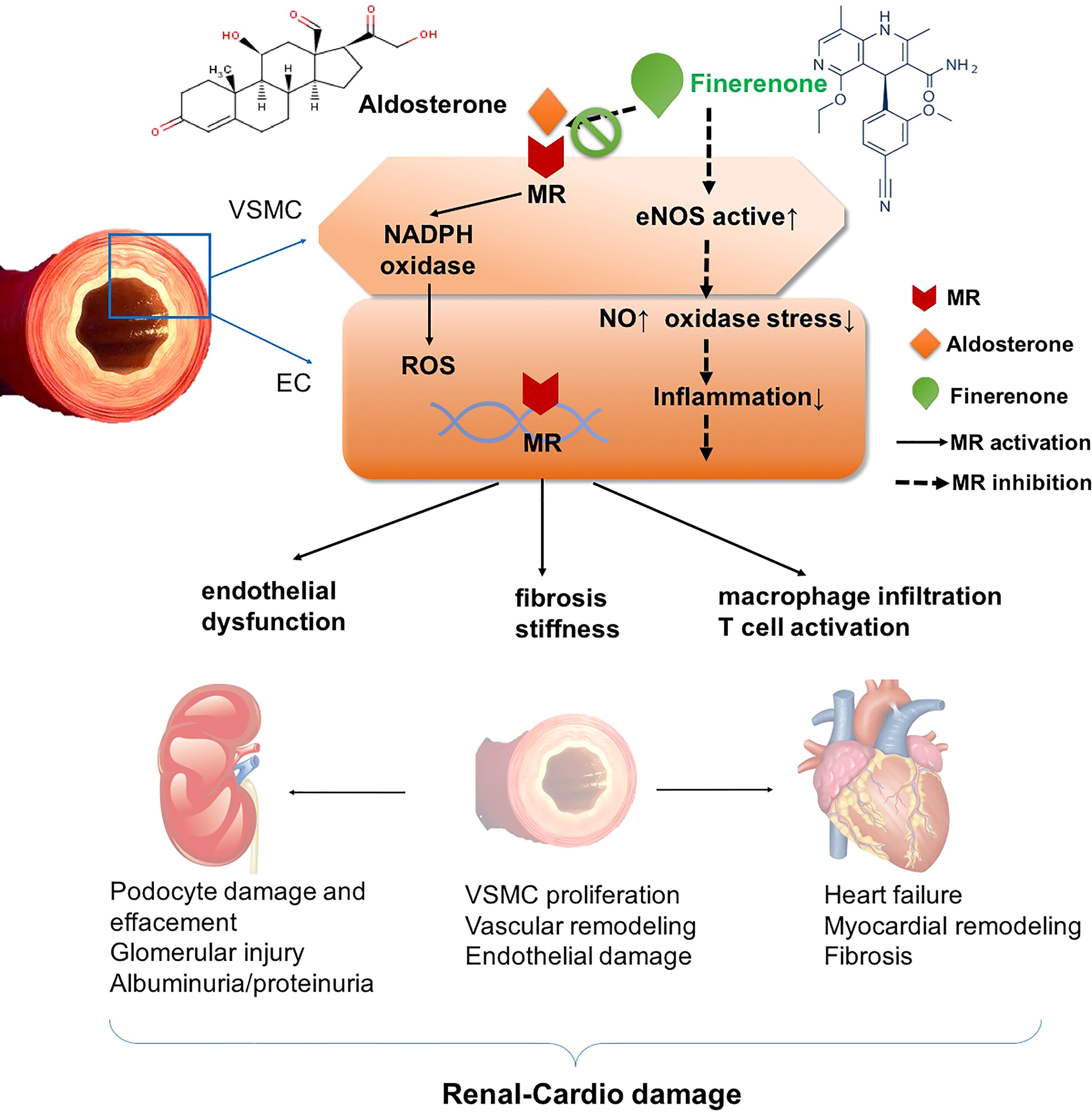 The Molecular Mechanism and Therapeutic Strategy of Cardiorenal Syndrome  Type 3