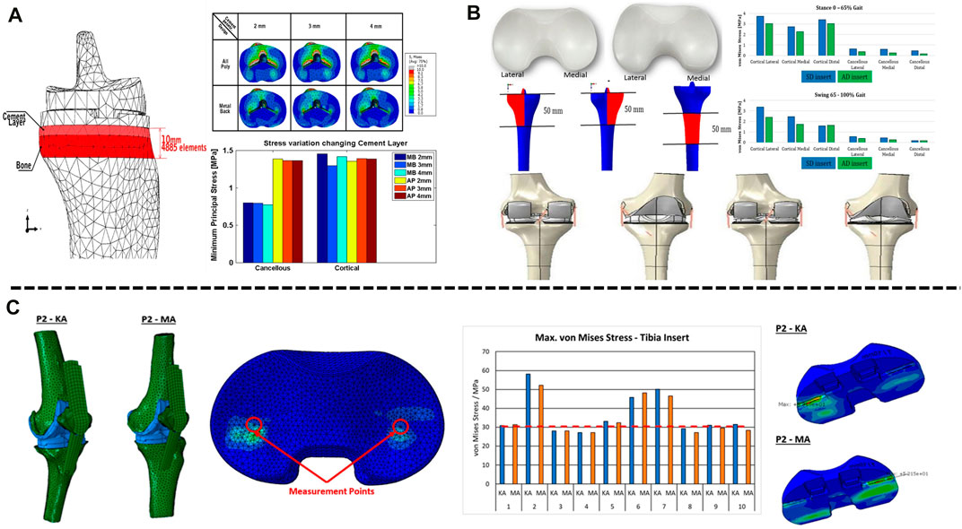 Solved] The contact between femoral and tibia components in knee joint