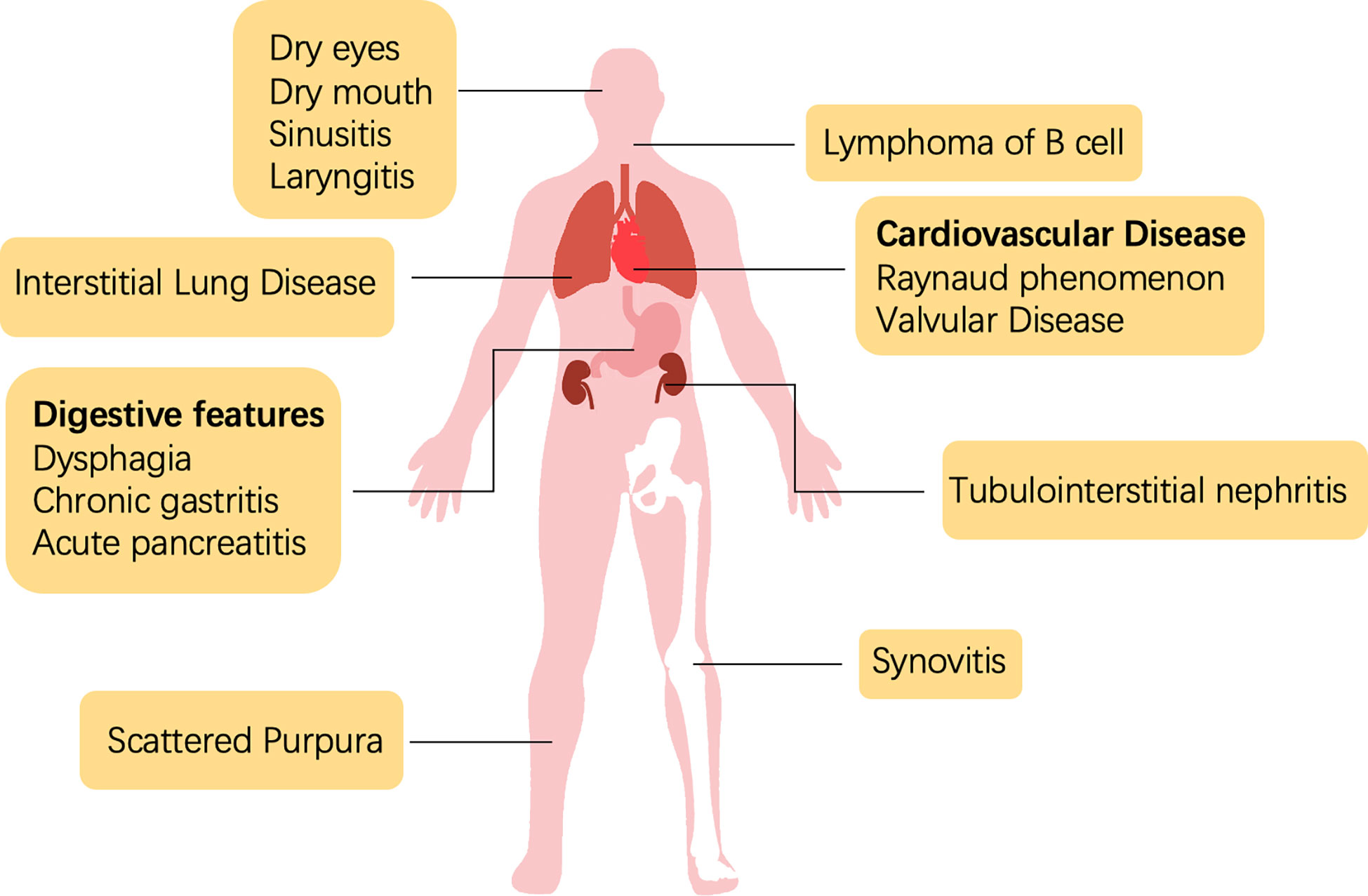 Sjogren Syndrome Video Anatomy Definition Function 48 OFF